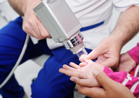 the doctor examines the special medical device moles childの写真素材