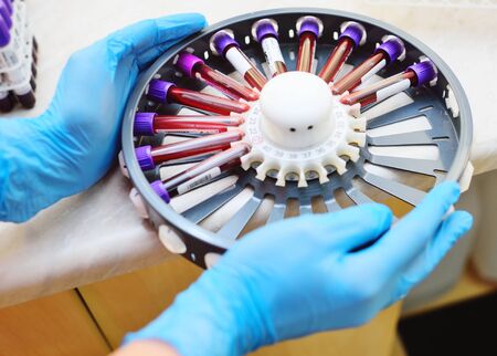 a doctor or a PCR technician in a bacteriological laboratory holds a centrifuge with blood samples in test tubes.の写真素材