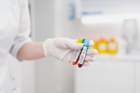 Blood test for antibodies covid 19.