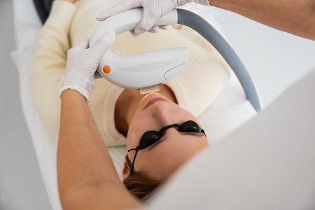 Phototherapy, photorejuvenation, IPL in a beauty salon. Care for a womans face.の写真素材