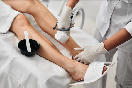 Laser epilation of legs in a beauty salon.の写真素材
