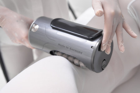 Anti-cellulite massage proven effectiveness Stratosphereの写真素材