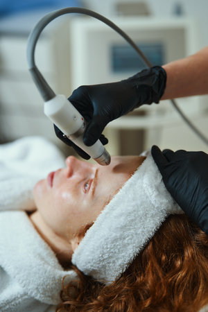 Skin care treatment session with microdermabrasion at a beauty clinicの写真素材