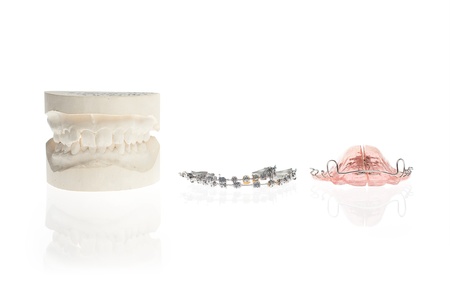 Orthodontics mould and retainers