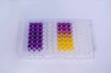 Laboratory Pharmaceutical test : antioxidant DPPH assay