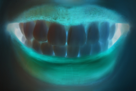 The teeth 
