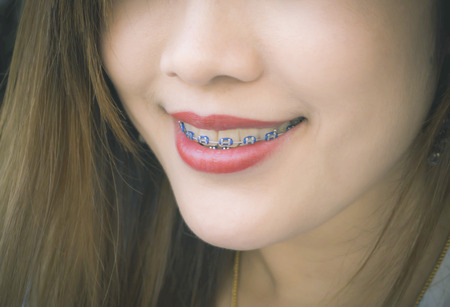Close up of Asian woman Mouth  with smileの写真素材