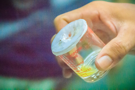 A beaker collects the milked green pit viper venom for produce snake antidote serumの写真素材