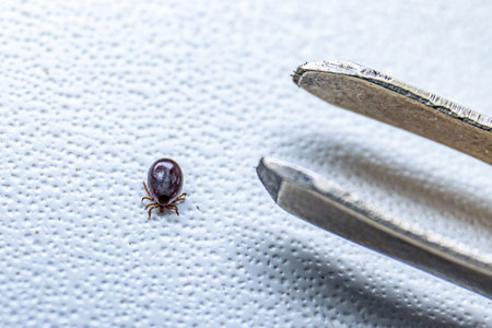Encephalitic tick removed with tweezers from the human body. Remove the dangerous blood-sucking insect from the skin.の写真素材