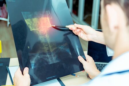 Experience male and female doctors orthopedics and team expert discussing x-ray film, surgery with the interpretation an x-ray in operating room in hospital .Medical technology and health care conceptの写真素材
