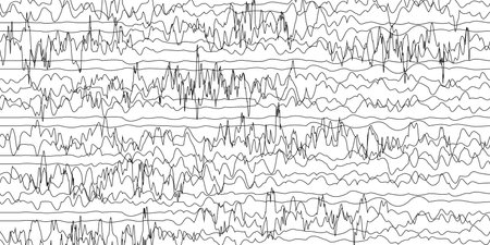 Vector illustration of sound waves on a white background. Sound waveform.のイラスト素材