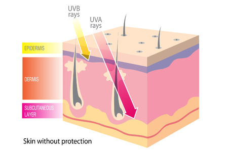 UV skinのイラスト素材