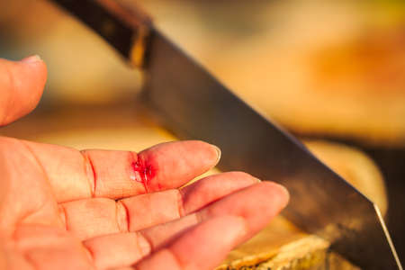 Injured finger with bleeding open cutの写真素材