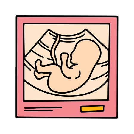 Ultrasound image with an embryo baby, pregnancy scanのイラスト素材