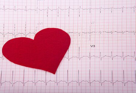 Tiny red heart sign on heart chart background. Health concept.