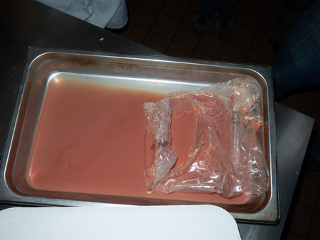 Tray with blood for transfusion in hospital. Blood donation.の写真素材