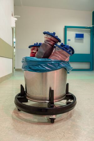 in a trash can in an operating theatre there are various suction containers filled with bloodの写真素材