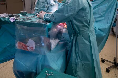 a surgical team performs a surgical abdominal operationの写真素材