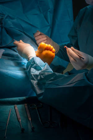 surgeon makes an incision on one foot with a scalpelの写真素材