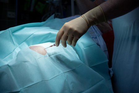 a doctor performs a knee puncture in an operating room with a cannula and a syringeの写真素材
