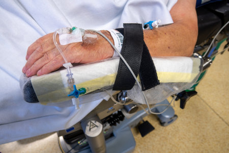in the hand of an operated patient is venous cannula for infusionの写真素材