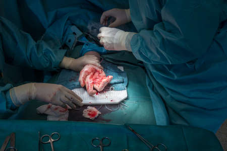 a doctor performs a hand surgery operationの写真素材