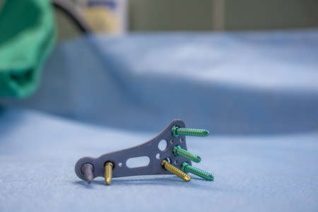 explanted titanium plate and various titanium screws of a radius fracture lie on a blue supportの写真素材