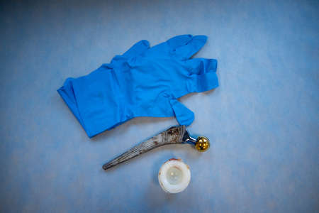 complete explanted hip prosthesis lies on one hand with a blue medical gloveの写真素材