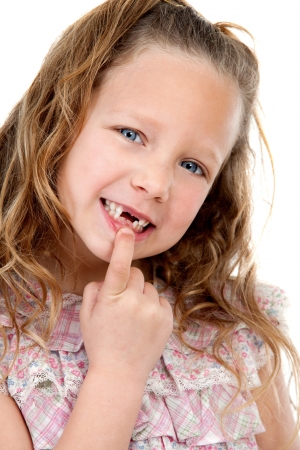 Close up Portrait of cute little girl showing her missing teeth  Isolated on white background の写真素材