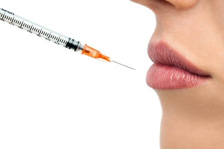 Macro close up of botox syringe and female lips.Isolated on white background.の写真素材