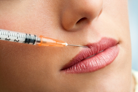Close up of syringe injecting botox into female lips.の写真素材
