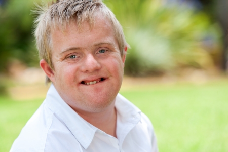 Close up facial portrait of handicapped young man outdoors.の写真素材