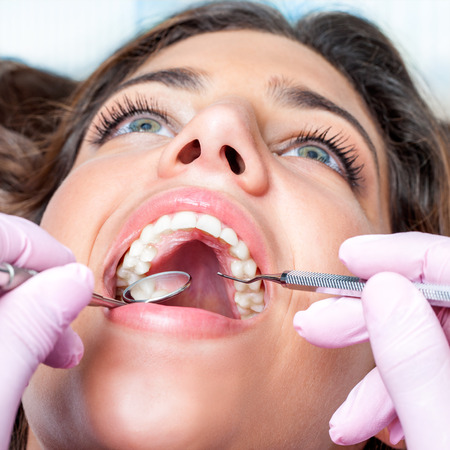 Extreme close up of Woman with open mouth at dental check upの写真素材