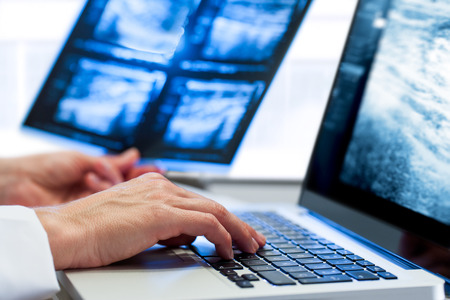 Extreme close up of medical practitioners hand introducing x-ray results on laptop.の写真素材
