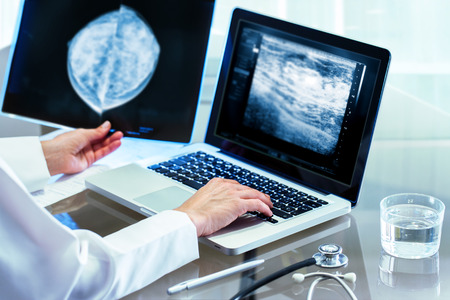 Close up of Doctor reviewing mammography results on x-ray and typing results on laptop.の写真素材
