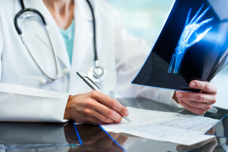 Close up of female doctor holding x-ray and writing down prescription at desk.の写真素材