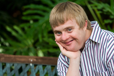 Close up facial portrait of handicapped young man outdoors resting chin on palm of hand.の写真素材