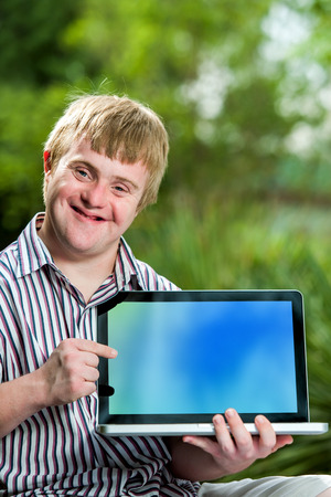 Close up portrait of handicapped student pointing at blank laptop screen against green outdoor background.の写真素材