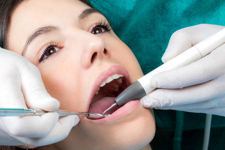 Close up macro face shot of girl at dental check up.Dental hygienist cleaning girls teeth with air scaler and mouth mirror.の写真素材