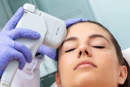 Close up of therapist doing removing sun damage on woman's forehead with high intensity ultrasound device.の写真素材