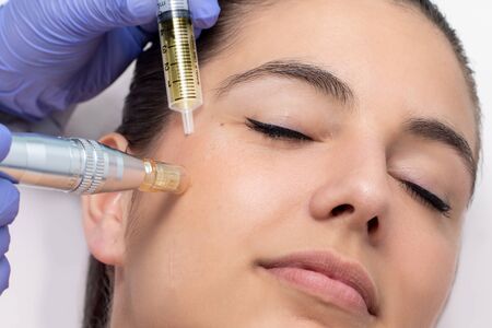 Close up of young woman having cosmetic mesotherapy facial. Therapist injecting pharmaceuticals with derma pen on cheek.の写真素材