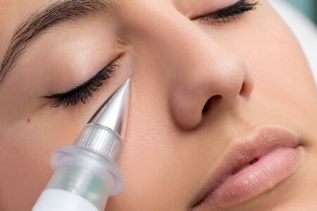 Macro close up of woman having noninvasive cosmetic facial with plasma pen. Cone shaped device doing skin tightening under eye.の写真素材