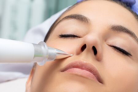 Macro detail of cone shaped plasma pen reducing wrinkles around cheek on young woman. Noninvasive cosmetic treatment.の写真素材