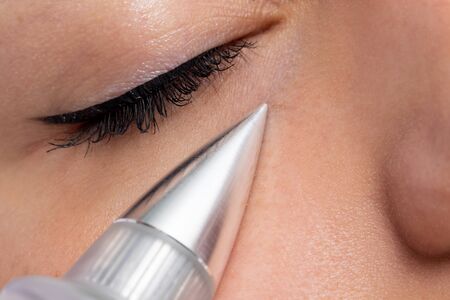 Macro close up of woman having noninvasive cosmetic facial with plasma pen. Cone shaped device doing skin tightening under eye.の写真素材