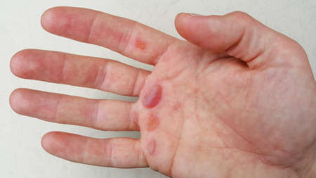 The calloused palm of a working man. The concept of work.の写真素材