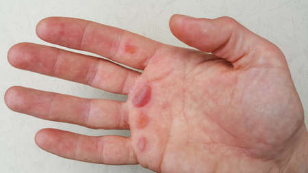 The calloused palm of a working man. The concept of work.の写真素材