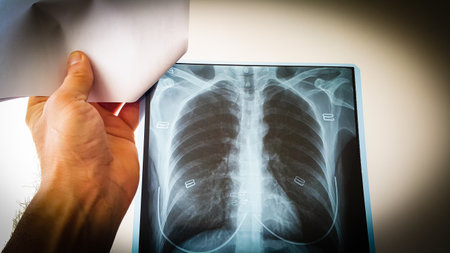 A doctor checks the x-ray film of the lungs and heart of a female patient in a hospital room.の写真素材