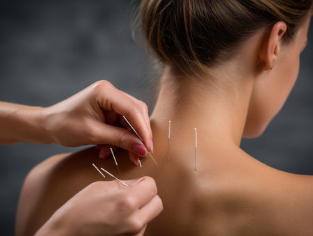Acupuncture treatment in modern clinic of alternative medicine, physician is putting needle Traditional Chinese Medicine, the installation of needles in an acupuncture procedure. High quality photoの素材