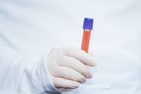 Test tube with blood sample in the doctor's hands.の写真素材