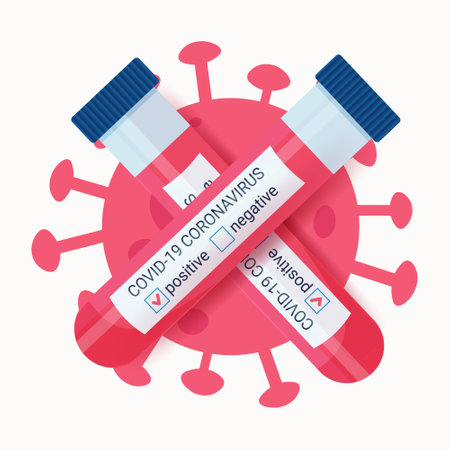 A positive test for antibodies to covid 19 infection. Blood test tubes. Vector illustration.のイラスト素材